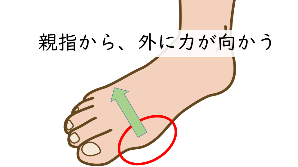 外反母趾は、親指から外側に向かって負荷がかかっているのが原因